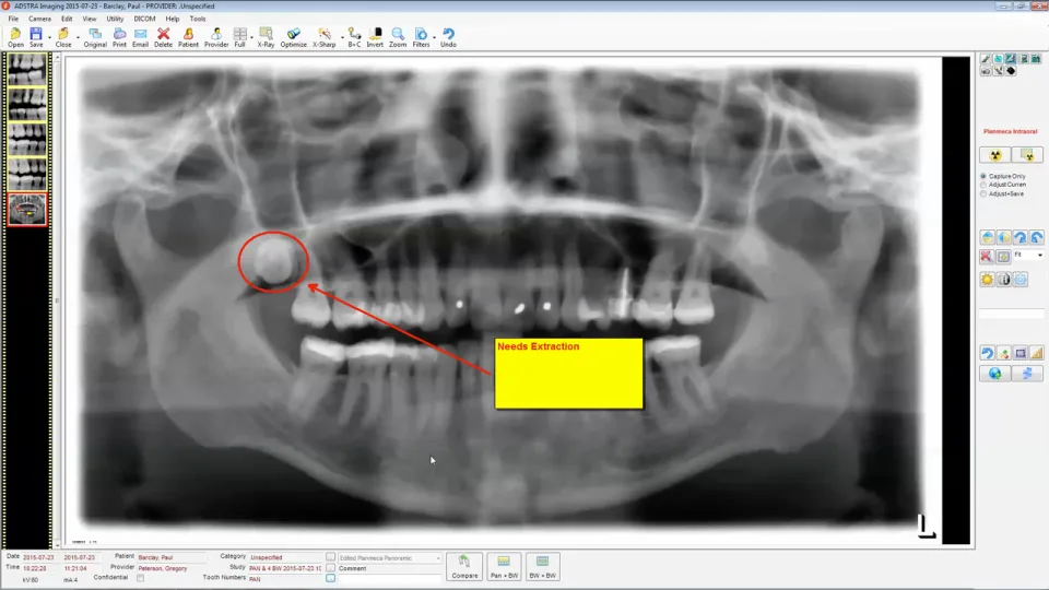 ADSTRA Dental Software Suite — Screenshots 3